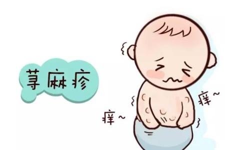 荨麻疹有哪些症状类型