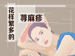 治疗荨麻疹要怎么护理保健