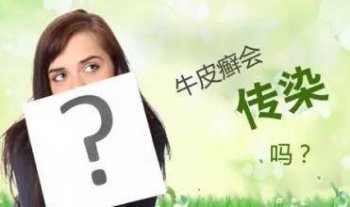 银屑病早期有哪些表现